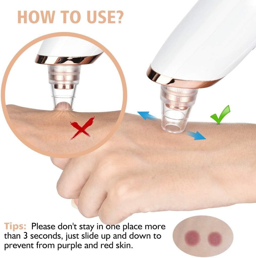 میکرودرم ابریژن خانگی مدل HY9