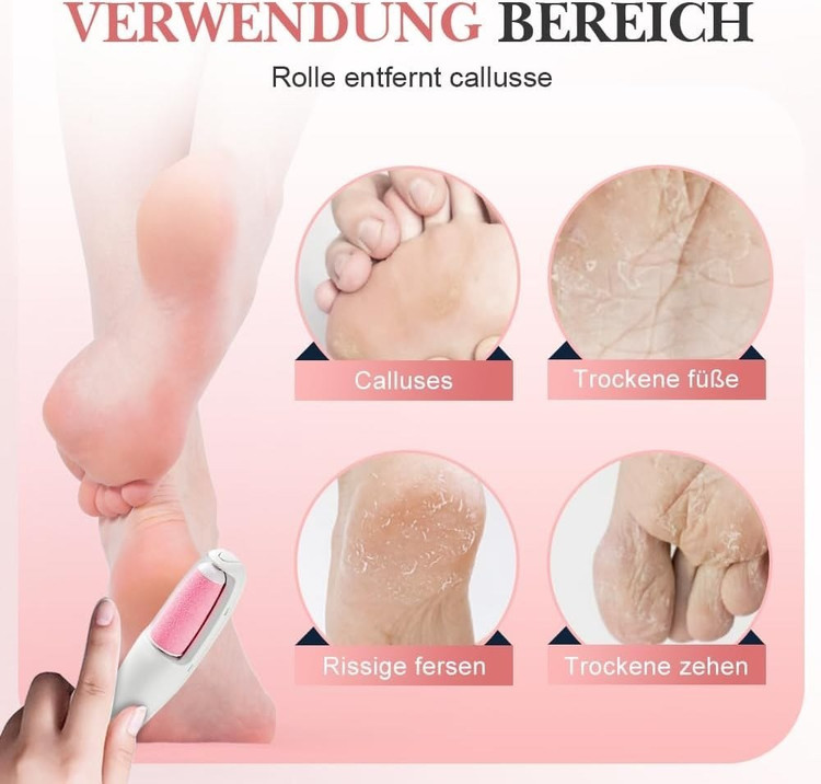 سنگ پا برقی و اپیلاتور موزن نانو کریستال چندکاره ۲ در ۱ | حذف مو و لایه‌برداری پوست